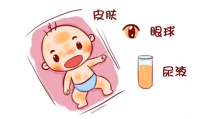 新生儿出生没黄疸，大多是孕妈在孕期做了3件事